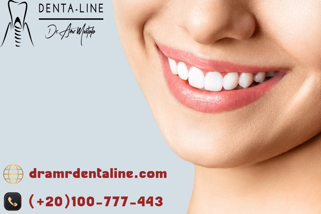 تبييض الاسنان في عيادة دينتل لاين