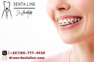 تقوييم الاسنان في دينتل لاين